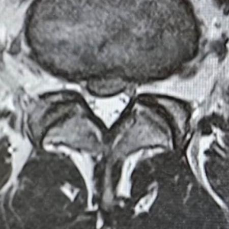 Magnetická rezonance Filipa Turka